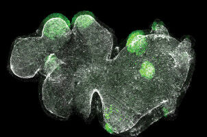 How cells choose between two fates
