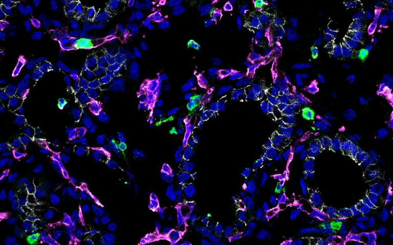 Immune cells could offer new avenues for treating respiratory diseases - Credit: