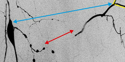 Mechanical forces in the nervous system play a corrective role