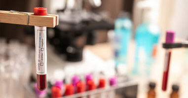 New insights from study could help understand long COVID better