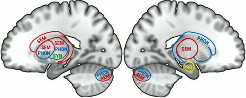 New insights into how the human brain organises language