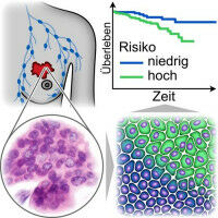 New marker for cancer cell motility