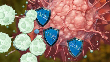 Prostate cancer: IOR contributes to significant advancement