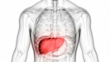 Risk assessment after severe complication of liver cirrhosis improved