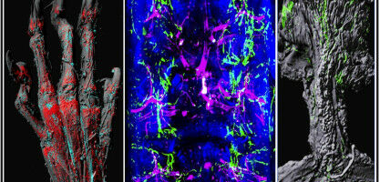 Role of lymphatic system in bone healing revealed