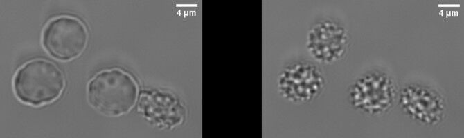 Shape-shifting cells at the flick of a switch