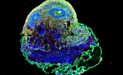A brain organoid as seen under a microscope. Image: Dr Hannah Leeson, AIBN.