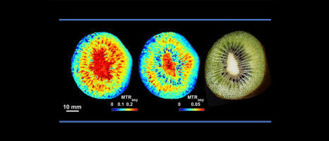 A Milestone in Plant Magnetic Resonance Imaging