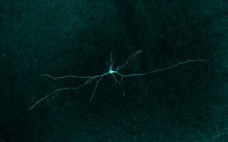 Brain's 'escape switch' controlled by threat sensitivity dial