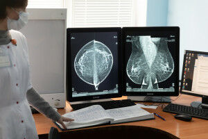 Breast cancer: a study evaluates the time it takes to return to work