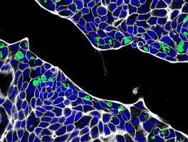 Chlamydia Can Settle in the Intestine
