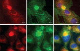 Cracking the secrets of virus 'uncoating' may help fight infections