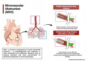 Fighting heart attack down to the smallest vessels