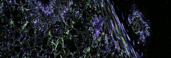 First-ever imaging of pathogens on lettuce leaves in real-time