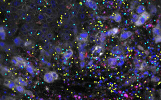 Major cause of inflammatory bowel disease discovered