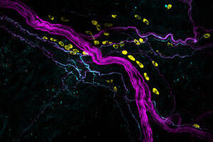 Mechanisms of postoperative pain revealed