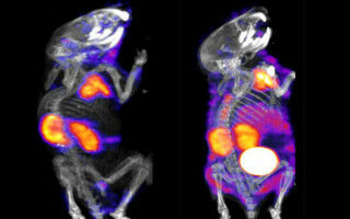 MRNA technology could be possible treatment for rare diseases