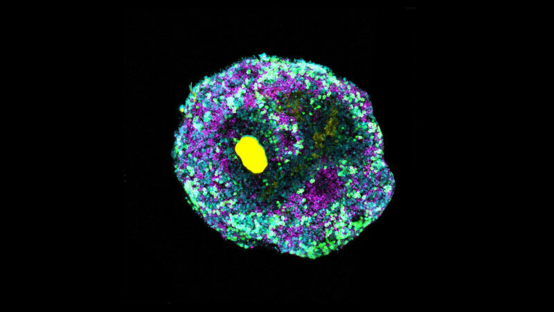 Retinal organoid with a microscopically small bead of DNA (yellow) and various r