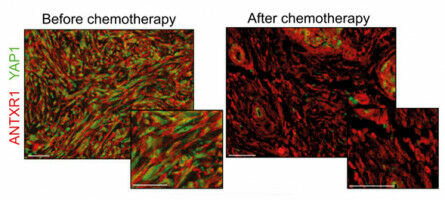 New therapeutic avenues to improve ovarian cancer treatment