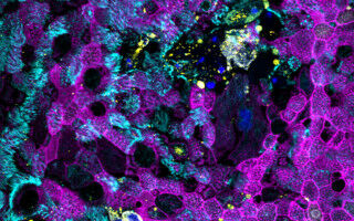 Specific nasal cells protect against COVID-19 in children