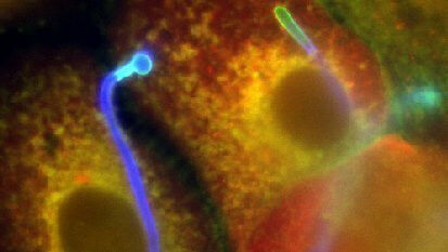 Candida albicans Hyphe (colored blue) penetrates human cells. Photo: Ricardo Alm