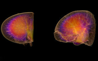Would astronauts' kidneys survive a roundtrip to Mars?