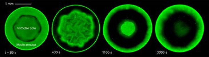 A Breath of Fresh Air: Bacteria Confined to Droplets Form Complex Patterns