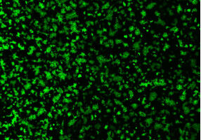 A porcine coronavirus uses an unexpected route to enter cells