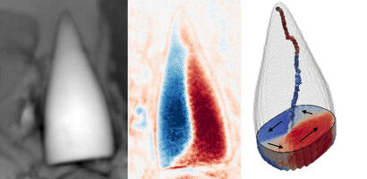 Ancient 'animal GPS' identified in magnetic fossils