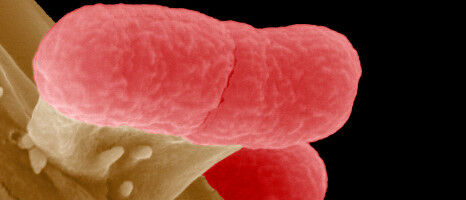 Antimicrobial resistance: AI predictions unreliable