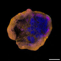 Can the monkeypox virus infect the human brain?