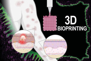 Fighting Skin Diseases with 3D Bioprinting