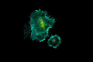 How immune cells deliver their deadly cargo