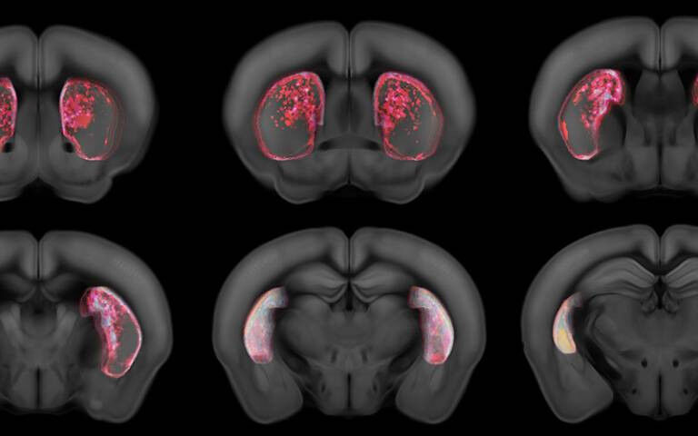 Mouse brain striatum - Triggered cell death in the tail of striatum in the mouse