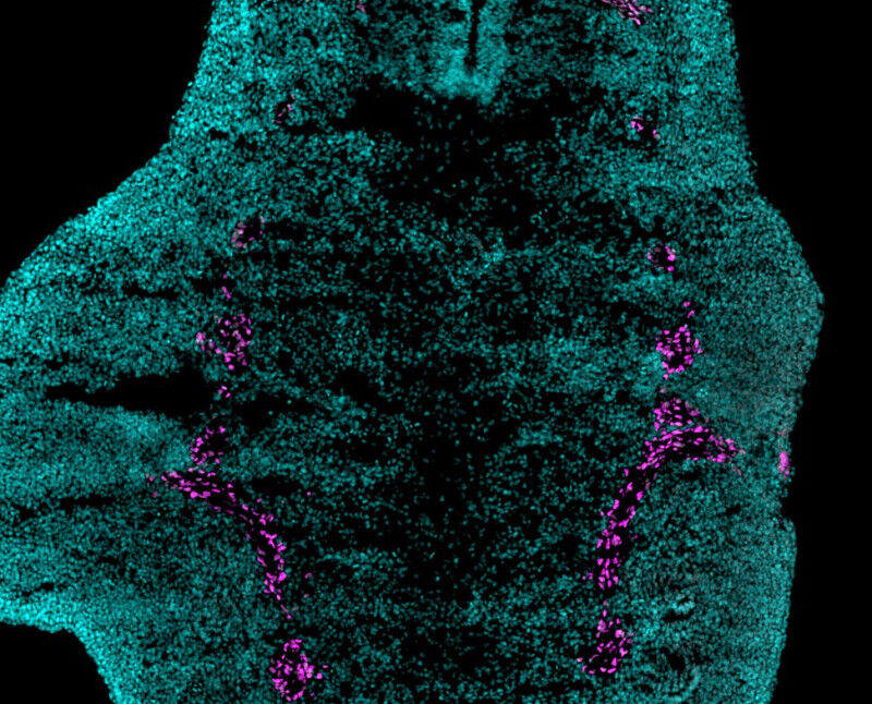 Known to play a key role in the development of many tissues, neural crest cells