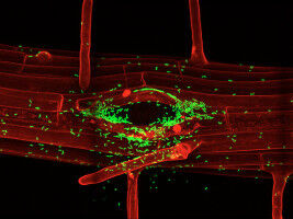 Plant microbiota: War and peace underground