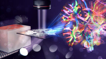 Milestone in mapping the brain's nerve fibre labyrinth