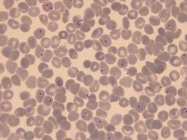 New Drug Candidate to Tackle Resistant Malaria Strains