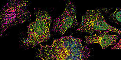 New way to improve the efficacy of innovative RNA therapies