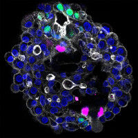 Patient-specific human liver model�