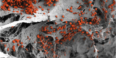 Researchers build bone marrow model entirely from human cells