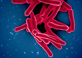 Susceptibility to bovine TB in cattle traced to key genes