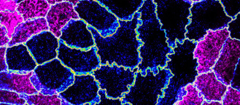 In pink, wild type cells expressing gamma actin. In black, knock-out cells that