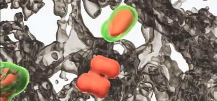 UCalgary researchers pursue new approach to manage deadly lung scarring