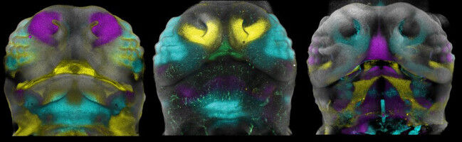 Why do our faces differ?