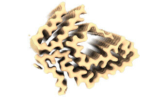 A skin biopsy to detect a rare neurodegenerative disease