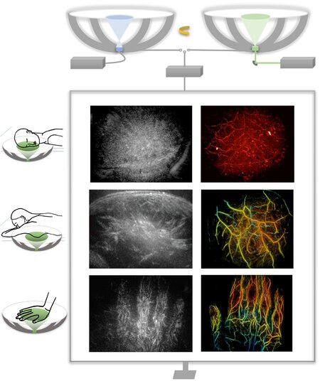 Hybrid rotational ultrasound and photoacoustic tomography (RUS-PAT) combines fas