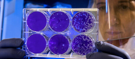 Building Immunity Against Avian Flu Risks