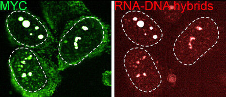 Decoded: How cancer cells protect themselves from the immune system