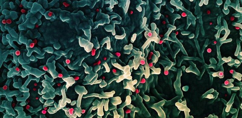 Colorized scanning electron micrograph of mpox virus (red) on the surface of inf